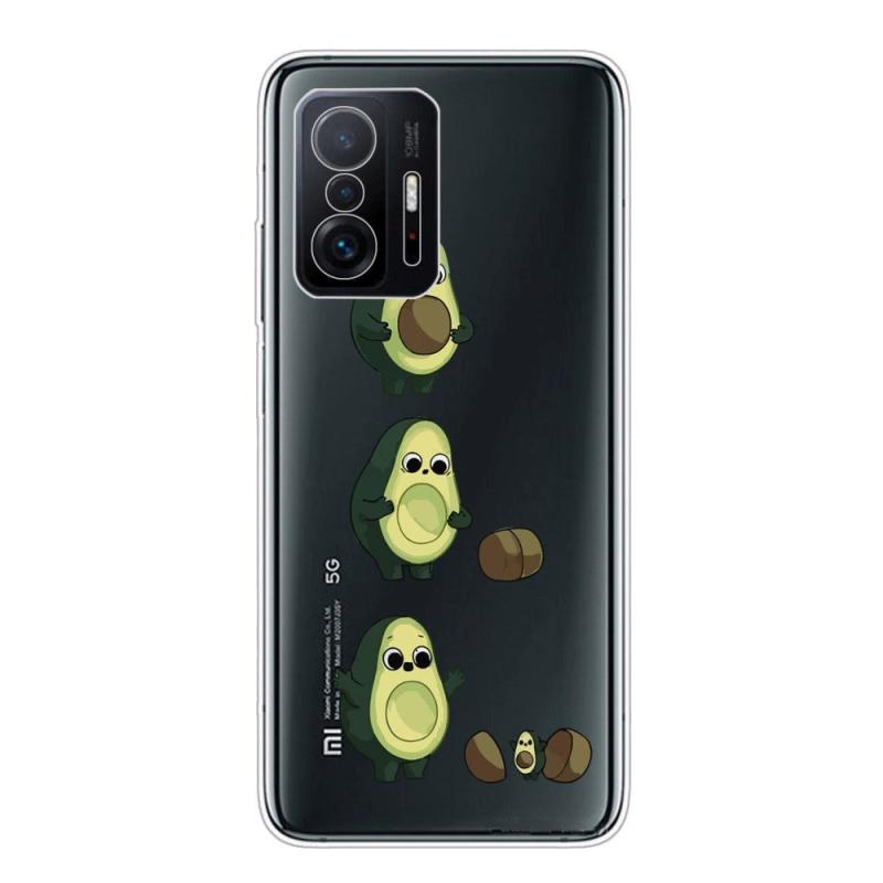 Xiaomi 11t   11t Pro Fleksibelt Plastik Bagside Cover    Print Avocado